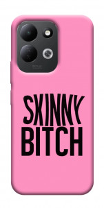 Чохол Skinny для Xiaomi Redmi 17