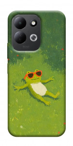 Чохол Жаб'ячий chill для Xiaomi Redmi 17