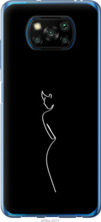 

Чохол Сілует1 на Xiaomi Poco X3 1577781