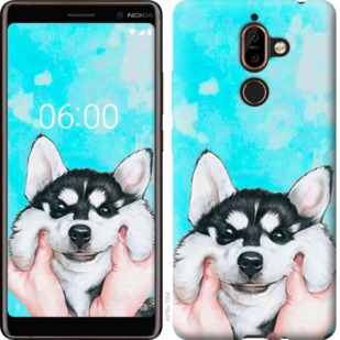 

Чехол Улыбнись для Nokia 7 Plus 720278