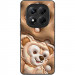 Фото TPU+PC чохол Prisma Fluffie на Xiaomi Redmi Note 14 Pro 4G (Dream) на vchehle.ua