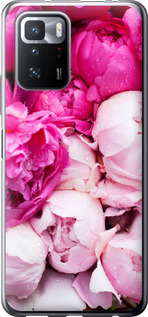 

Чохол Рожеві півонії на Xiaomi Redmi Note 10 Pro 5G 1696026