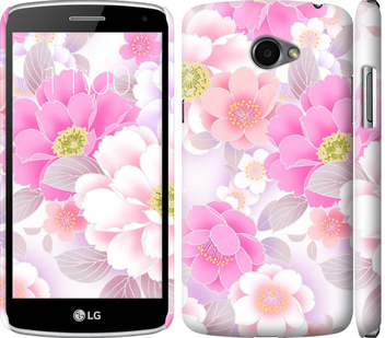 

Чохол Цвіт яблуні на LG K5 X220 144880
