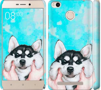 

Чохол Посміхнися на Xiaomi Redmi 3x 720096