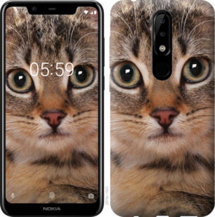 

Чехол Полосатый котик для Nokia 5.1 Plus 879202