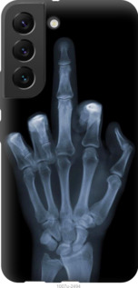 

Чехол Рука через рентген для Samsung Galaxy S22 1579781