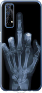 Чехол Рука через рентген для Realme 7