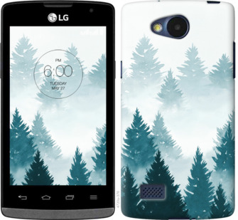 

Чехол Акварельные Елки для LG Joy H220 862602